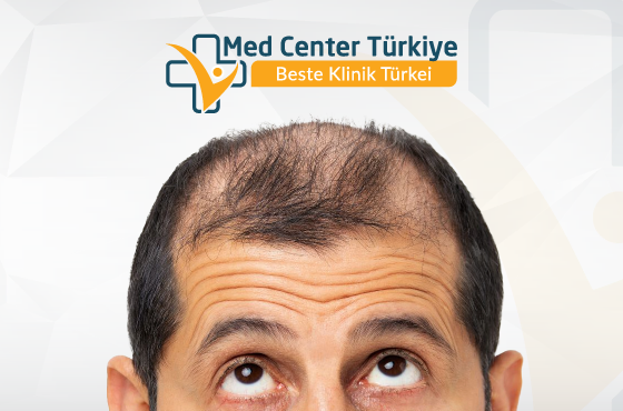 Erfahren Sie mehr über Haarausfall Kontaktieren Sie uns