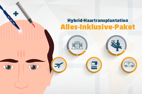 Hybrid Haartransplantation Turkei Alles Inklusive Paket