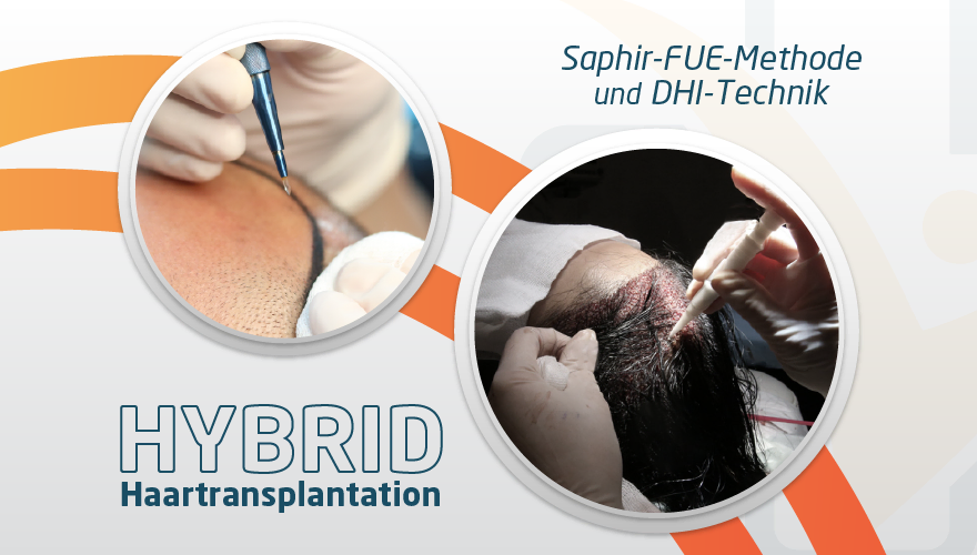 Hybrid-Haartransplantation Türkei