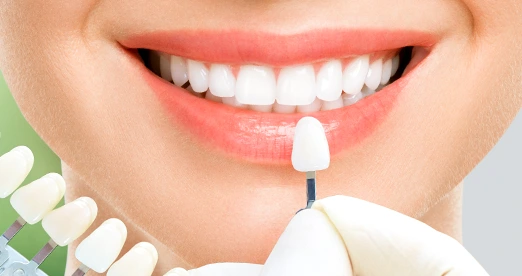 Zirkonkrone Turkei Antalya Kosten Zirkonium Zähne Türkei ✓ niedrige Kosten ✓ All incl. Paket ✓ Behandlung in Antalya – ↓Kostenlose Online-Beratung↓ Ratenzahlung ✓ ab220€ ✓