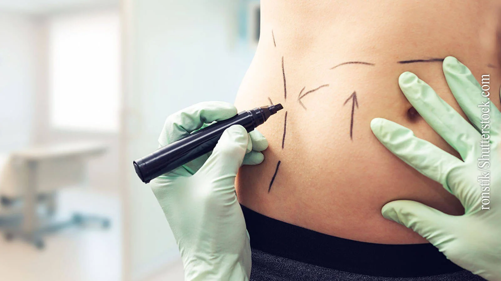 Ästhetische Chirurgie in der Türkei: Qualitativ und Preiswert