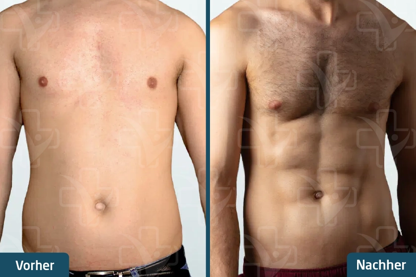 before after 4