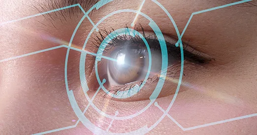 PRK-Laser Türkei
