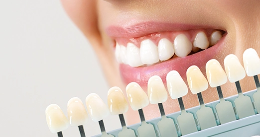 Beste Zahnklinik Türkei – Zahn-Veneers Center Türkiye Zirkonium-Kronen Türkei Zahnbehandlung
